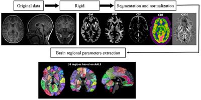 Diagnosis of children with attention-deficit/hyperactivity disorder (ADHD) comorbid autistic traits (ATs) by applying quantitative magnetic resonance imaging techniques